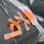 trauma 1501260221