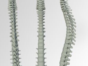 Wurde BK Stocker wirklich operiert? Kronen Zeitung spaltet Meinungen